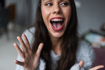 Cheerful young woman showing her colorful braces while smiling and expressing joy