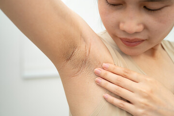 Asian woman have problem black armpit beauty skin care.