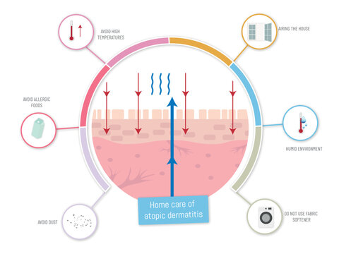 Home care of atopic dermatitis, infographic showing correct treatments