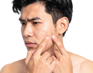 A young man examines and squeezes acne on his cheek, showing concern about his skin condition against a black background.
