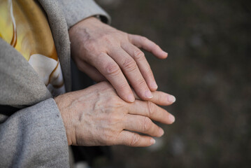 Close-up of elderly woman’s hands gently resting together outdoors.