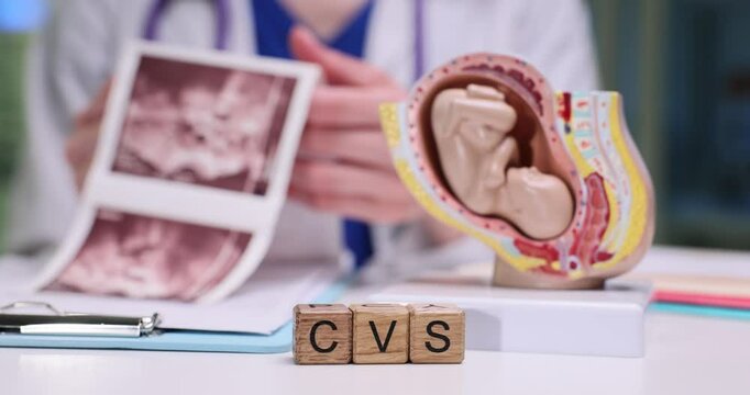 A healthcare provider reviews the CVS process using a model and ultrasound prints in a clinical setting