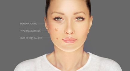 effects of sun exposure on facial skin