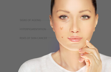 effects of sun exposure on facial skin