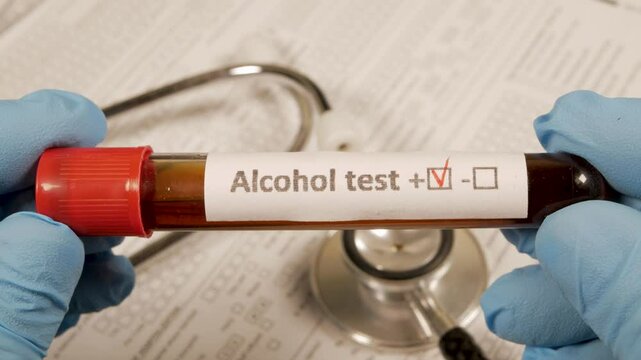 Doctor showing positive alcohol test tube
