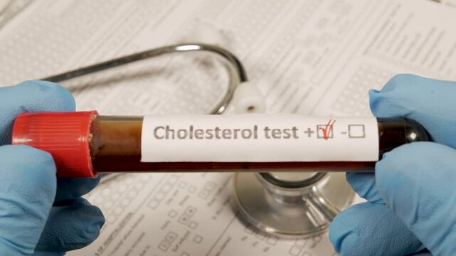 Doctor showing cholesterol test tube with positive result