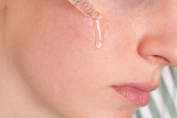Close-up of a dropper applying serum to woman's cheek. Concept of skincare, moisture, and facial...