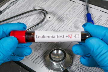 Doctor holding leukemia blood test with positive result
