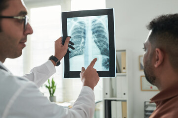 Middle aged Caucasian male doctor showing and explaining chest X ray image to middle aged Black man...