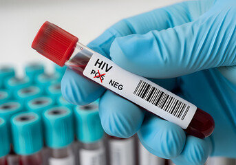 A gloved hand holds a blood sample, labeled 'HIV NEG', showing a negative test result.