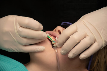 Dental treatment. Orthodontic treatment. Girl with saliva ejector at the dentist. Putting blue gel on tooth
