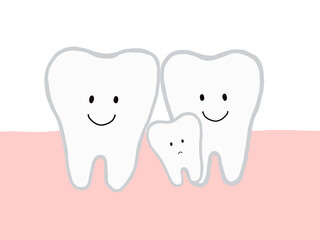 歯と歯の間：埋没歯・過剰歯のあるイラスト・主線あり