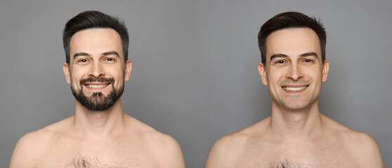 Handsome man before and after shaving on grey background, collage of photos. Banner design