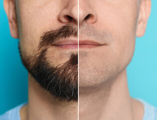 Man before and after shaving on light blue background, closeup. Collage of photos