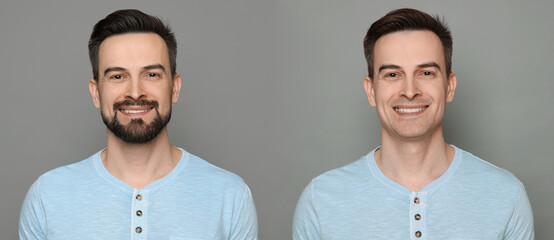 Handsome man before and after shaving on grey background, collage of photos. Banner design