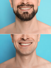 Man before and after shaving on light blue background, closeup. Collage of photos