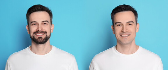 Handsome man before and after shaving on light blue background, collage of photos. Banner design