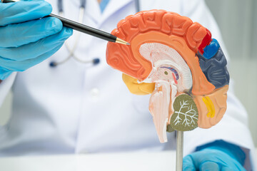 Alzheimer disease, Asian doctor holding brain anatomy model for study diagnosis and treatment in...
