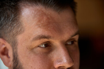Skin-realism. Sun-kissed forehead, visible tan lines and real pores. Concept of natural beauty, no...