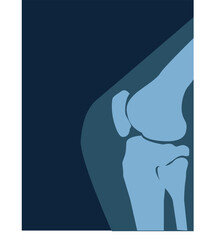  X ray image of the knee
