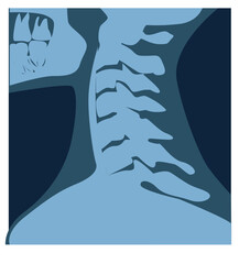 x ray image of the neck
