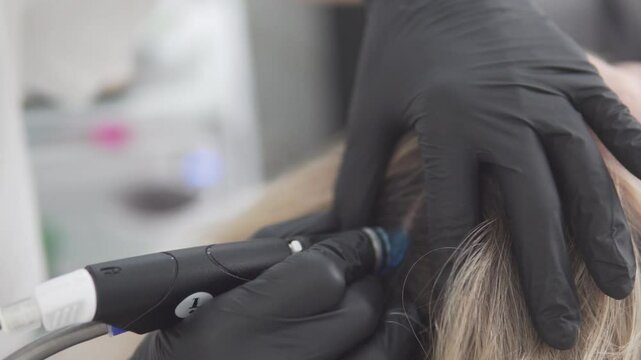 Scalp mesotherapy procedure. Trichologist using a special device for hair treatment. Close-up of hands in black gloves performing hair care in a clinic