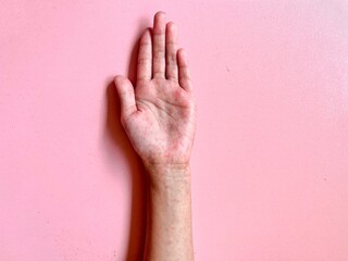 hand with red rush