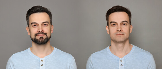 Handsome man before and after shaving on grey background, collage of photos. Banner design