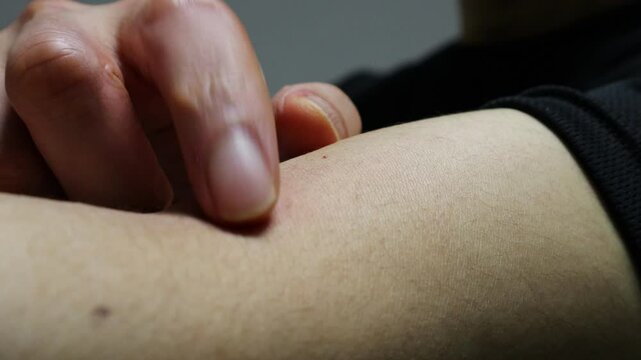 蚊に刺された腕を掻く人物の動画