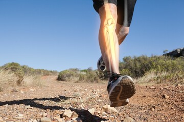Runner experiencing leg pain