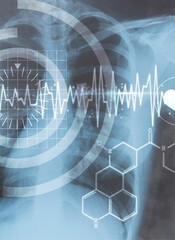 Medical interface on xray