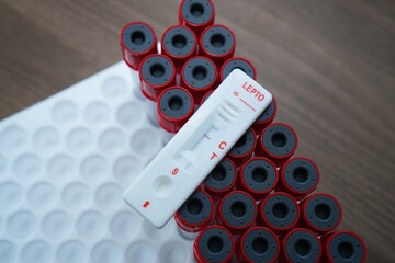 Blood sample of patient negative tested for leptospirosis by rapid diagnostic test on top of red...