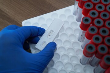 Hepatitis B virus positive test result by using rapid test cassette, Doctor or medtech in gloves...