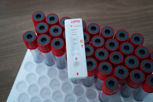 Blood sample of patient negative tested for leptospirosis by rapid diagnostic test on top of red vacuum tube.