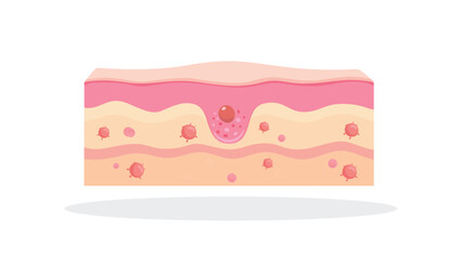 skin