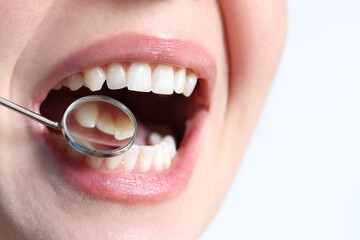 Fototapeta premium Smiling woman at the dentist, close-up. Dental mirror. Dentist examines patient's teeth with a dental mirror. Dentistry and oral hygiene concept. Real white teeth, not veneers. Close-up of teeth