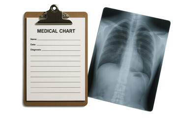 Medical chart on clipboard and chest x ray image for diagnosis and treatment