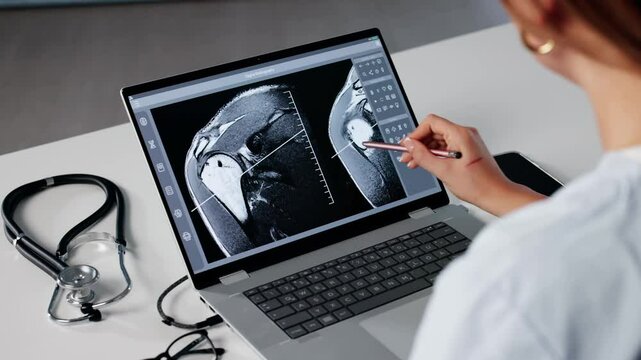 Surgeon Reviews MRI On Computer