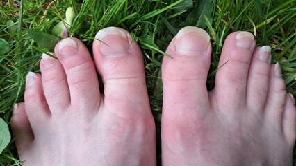 Close-up of two bare feet with long toenails resting on lush green grass, showcasing natural beauty...