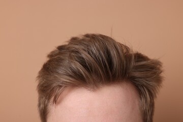 Man after hair loss treatment on beige background, closeup