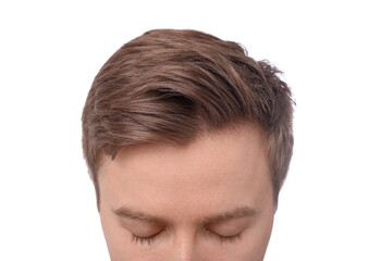 Man after hair loss treatment on white background, closeup