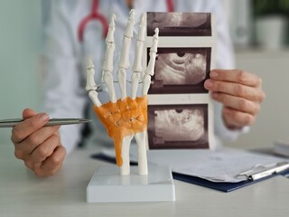Doctor examining a hand model while holding ultrasound images