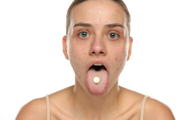 Young woman with acne showing tongue and pill, studio shot on white background.