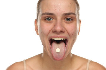 Happy young woman with acne showing pill on tongue, studio shot on white background.