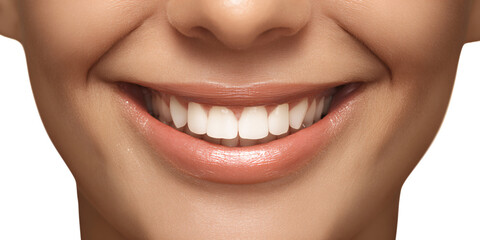 Obraz premium Closeup of a smiling Caucasian woman with perfect white teeth and glossy lips Concept of dental care, beauty, and healthy smile