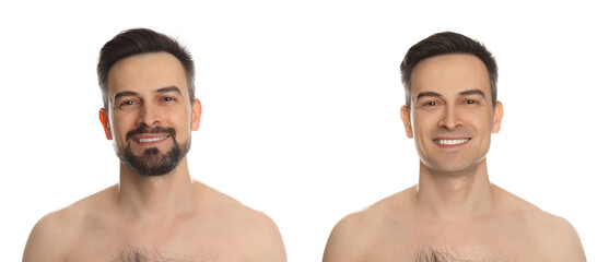 Handsome man before and after shaving on white background, collage of photos