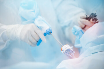 Surgeons performing laparoscopic surgery for extraction of kidney stones in operating room