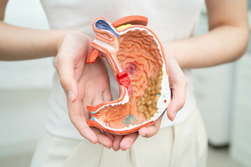 Stomach disease, Asian woman holding anatomy model for study diagnosis and treatment in hospital.