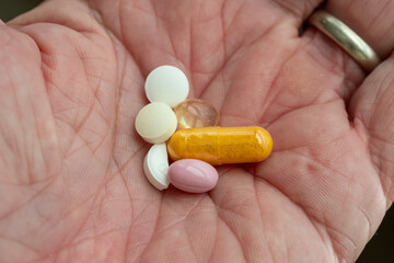 Closeup of Pills in a Caucasian Man's Hand
