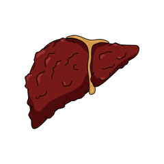 Autoimmune hepatitis disease. Liver organ with inflammation, infection and virus. Inflammation in human body. Vector illustration for medical, clinic or biology study